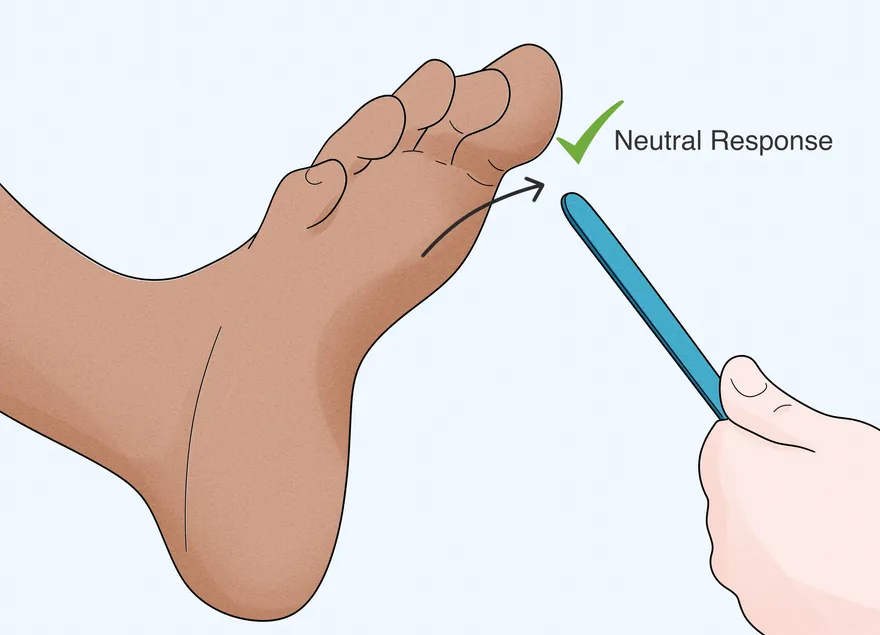 Como verificar o reflexo de Babinski