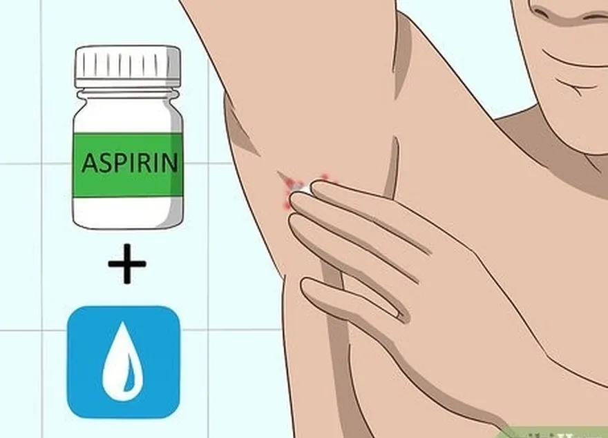 Etapa 8 Mantenha uma aspirina úmida contra a mordida como alternativa a outros tratamentos.