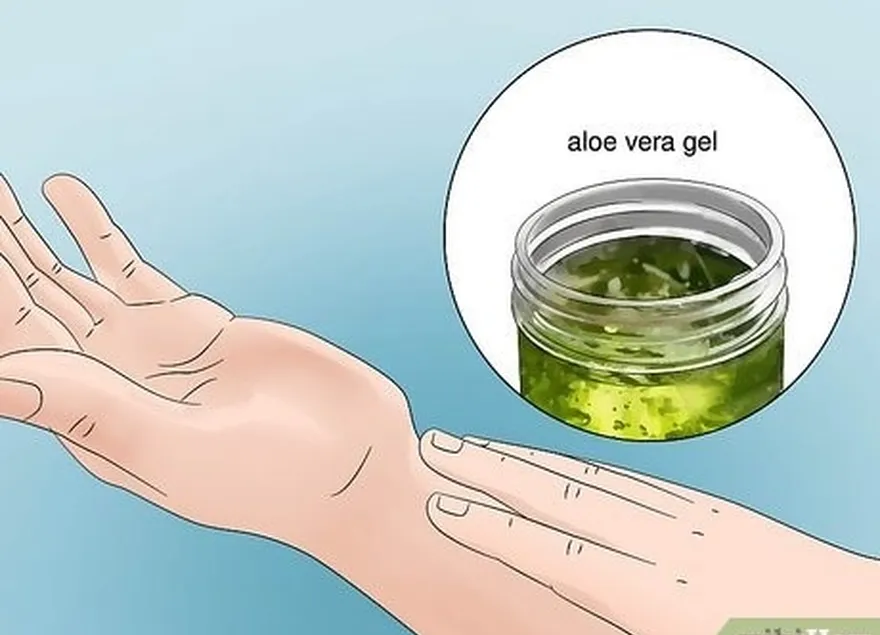 Etapa 2 Aplique um pouco de gel de aloe vera para esfriar e acalmar a pele.