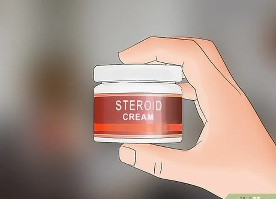 Etapa 2 Peça ao seu médico uma receita de creme esteroide para tratar a coceira.