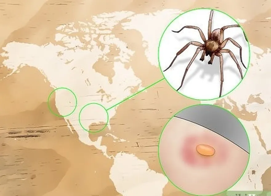 Etapa 3 Procure uma bolha cheia de líquido para indicar uma picada de reclusa marrom.